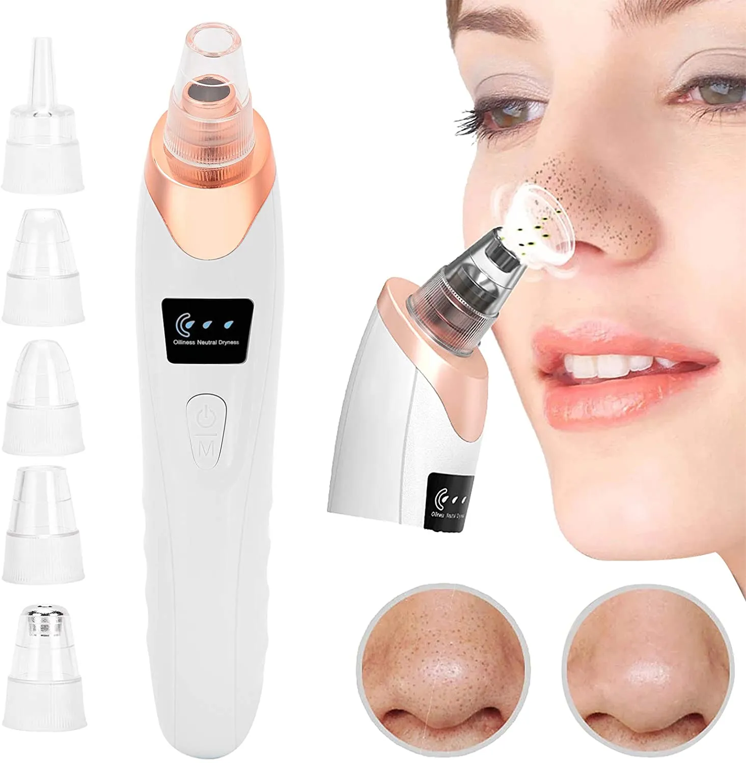 Electric Blackhead Removal Device Pore Cleanser Gadget Microcrystal Household Pore Cleaner Professional Beauty Instrument